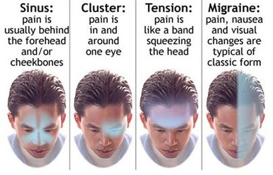 chiropractor for headaches