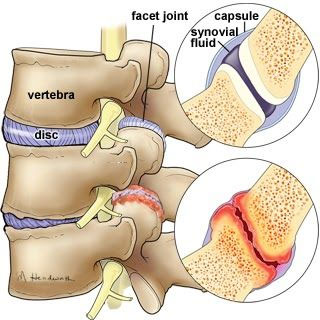 chiropractor for shoulder pain