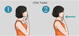 Chin Tuck exercise